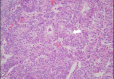Fig 10