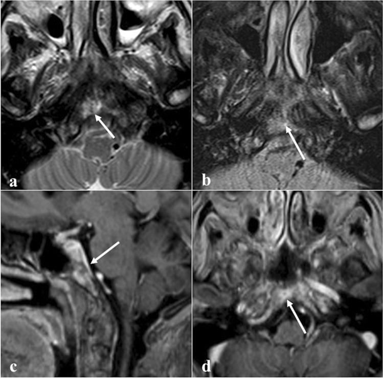 Fig. 19