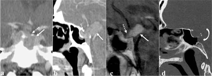 Fig. 11