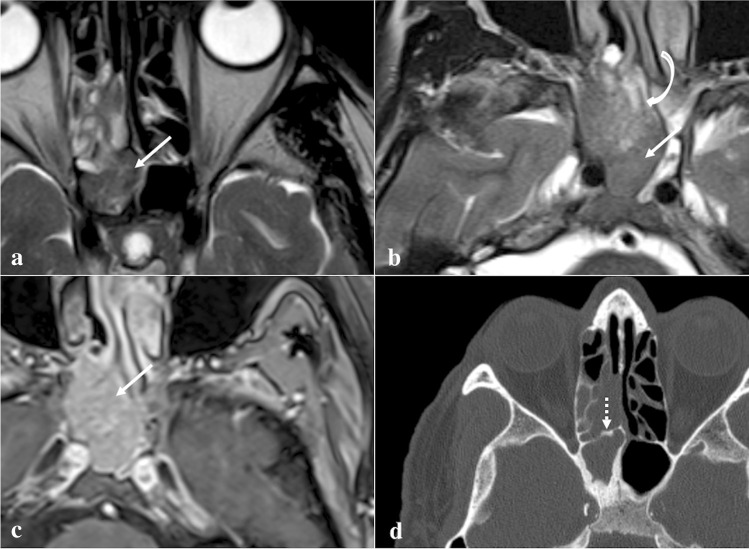 Fig. 12