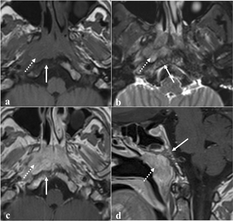 Fig. 14