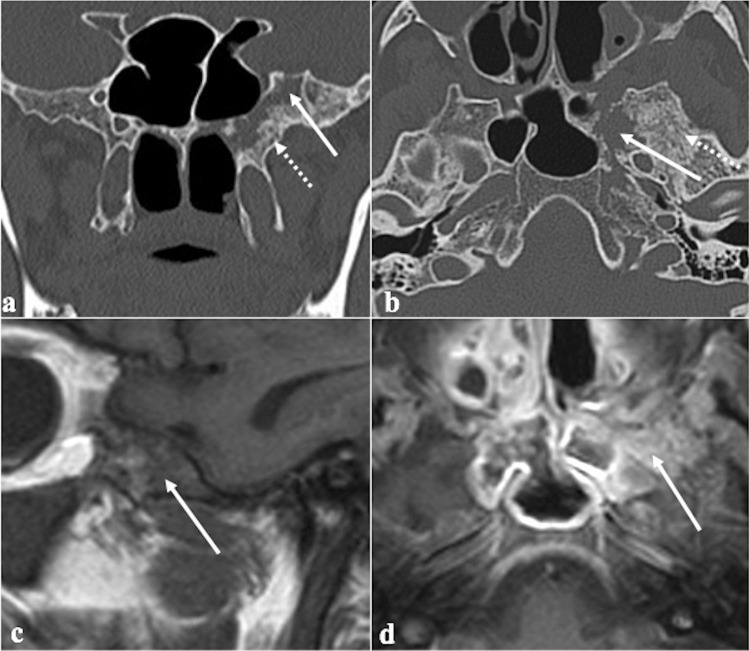 Fig. 18