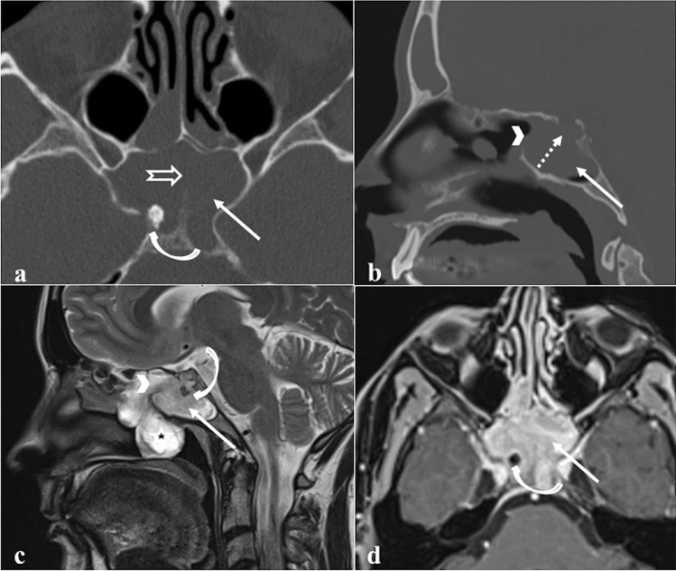 Fig. 15