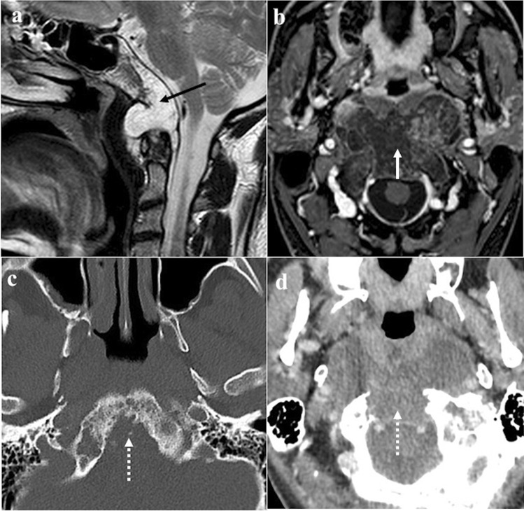 Fig. 13