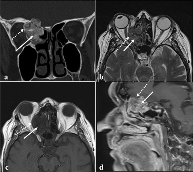 Fig. 10