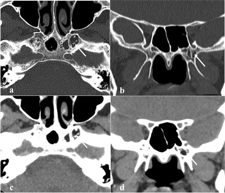 Fig. 9