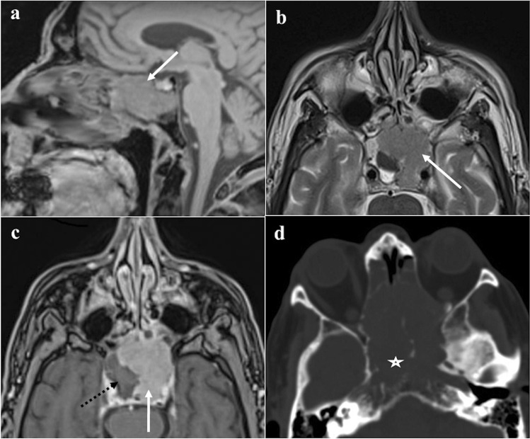 Fig. 17