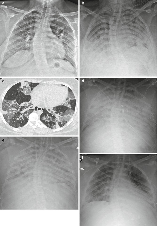 Fig. 5