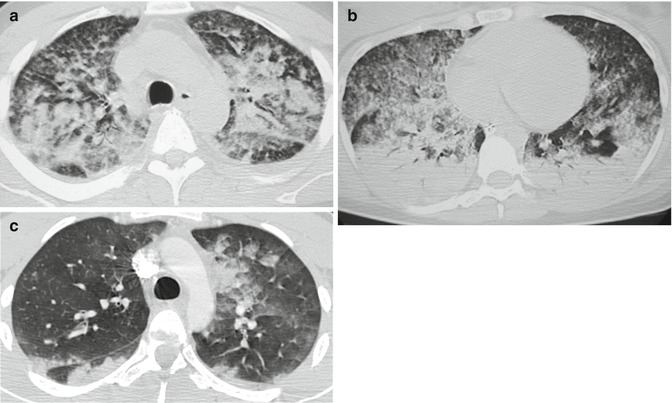 Fig. 14