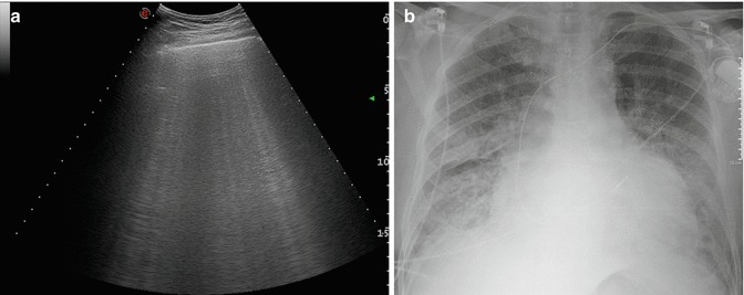 Fig. 21