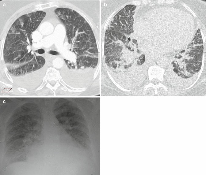 Fig. 23