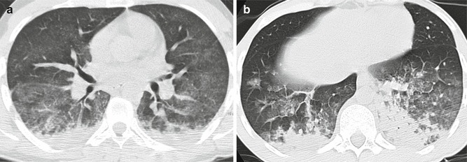 Fig. 15