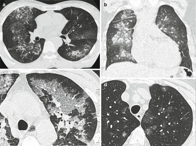 Fig. 10