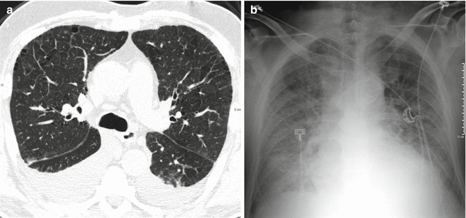 Fig. 22