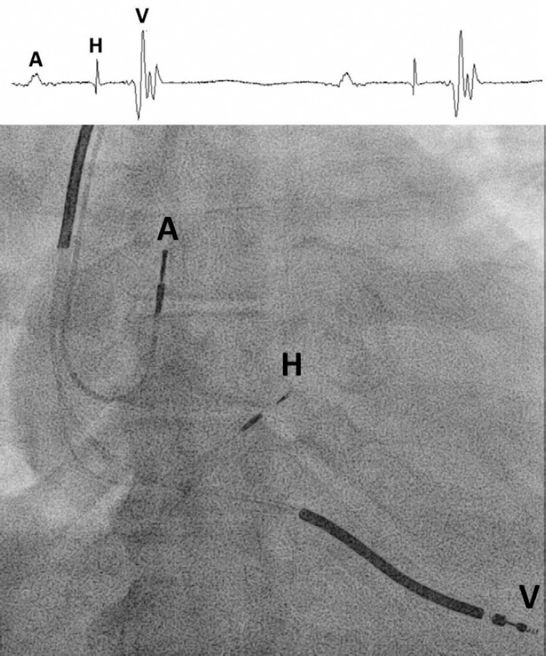 Figure 1: