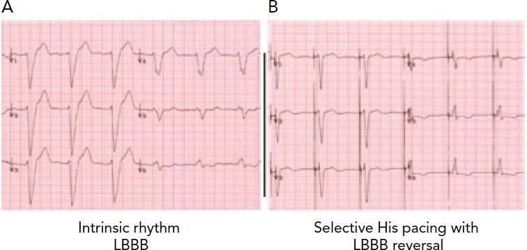 Figure 3: