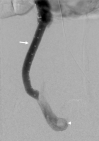Fig 2:
