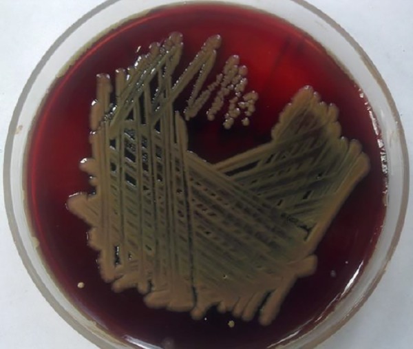 Figure 1: Showing β-haemolytic colonies on blood agar medium with tan pigment