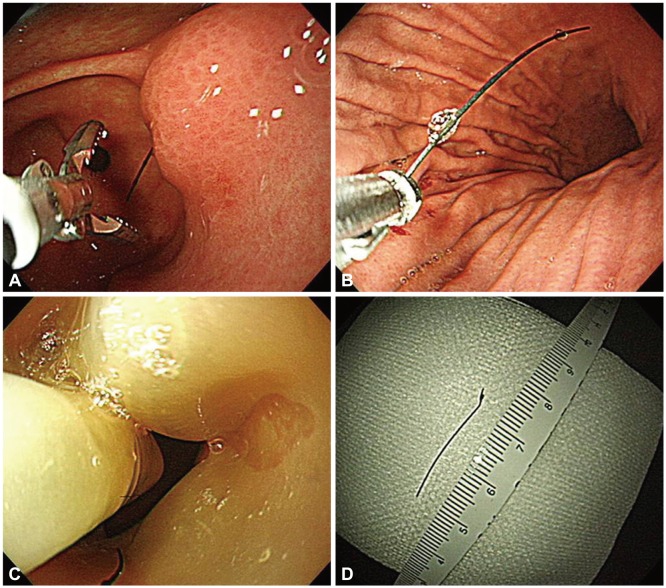 Fig. 4