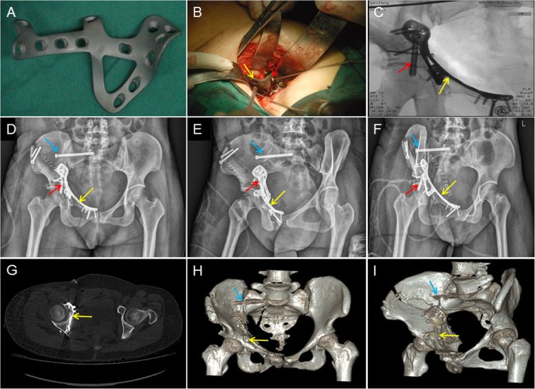 Fig. 3