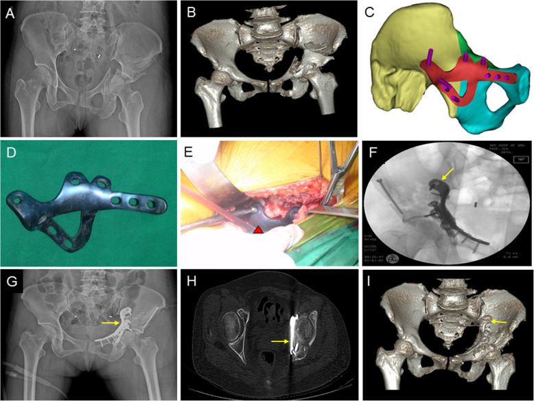 Fig. 4