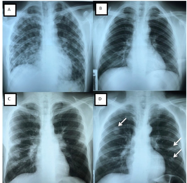 FIGURE 2: