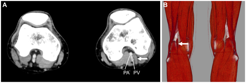 Fig 2