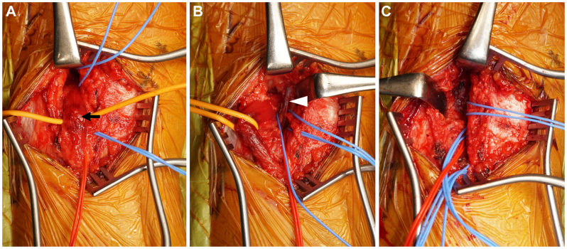 Fig 3