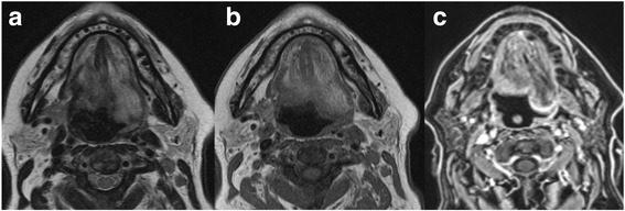 Fig. 11