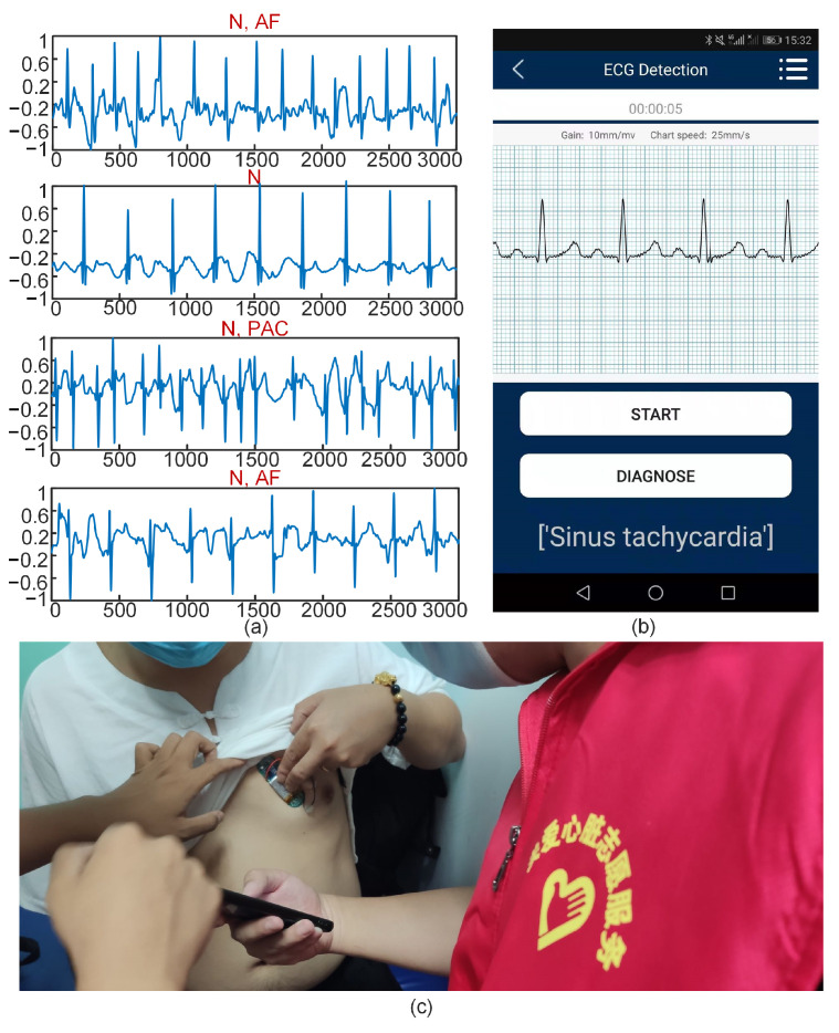 Figure 14