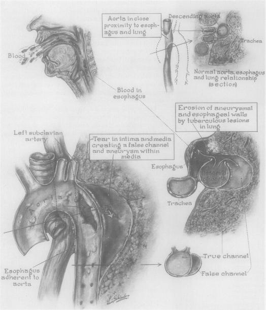 Fig. 11.