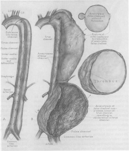 Figs. 10A and B.