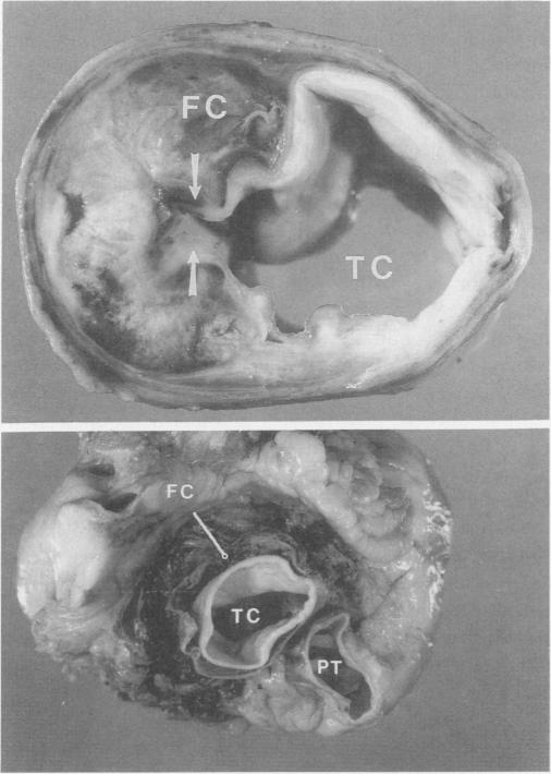 Fig. 13.