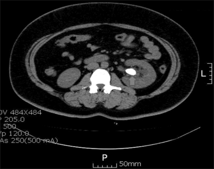 FIG. 1