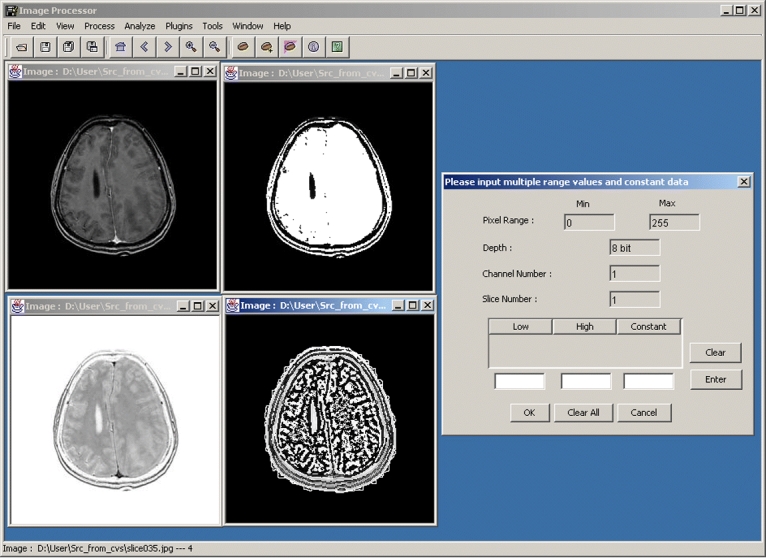 Fig 5