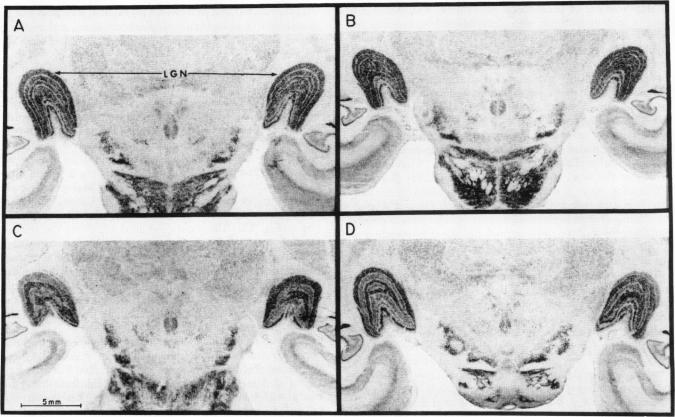 graphic file with name pnas00657-0690-a.jpg