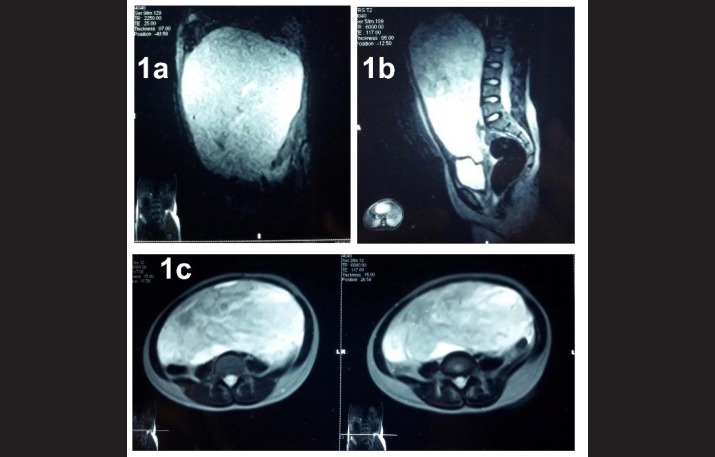 Fig. 1 (a, b, c)