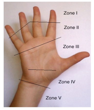 Fig. (1)