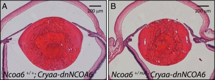 Figure 11.