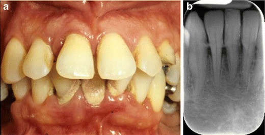 Fig. 6