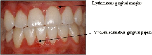 Fig. 5