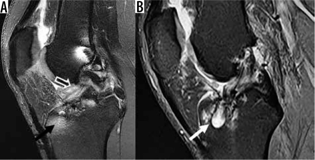 Figure 23