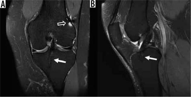 Figure 21