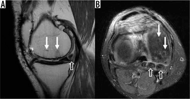 Figure 36