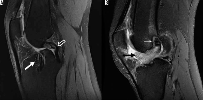 Figure 22