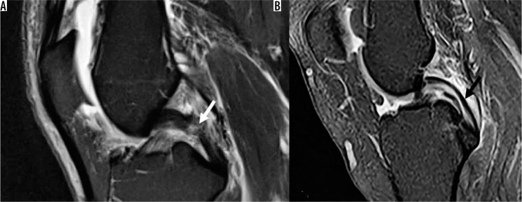 Figure 25