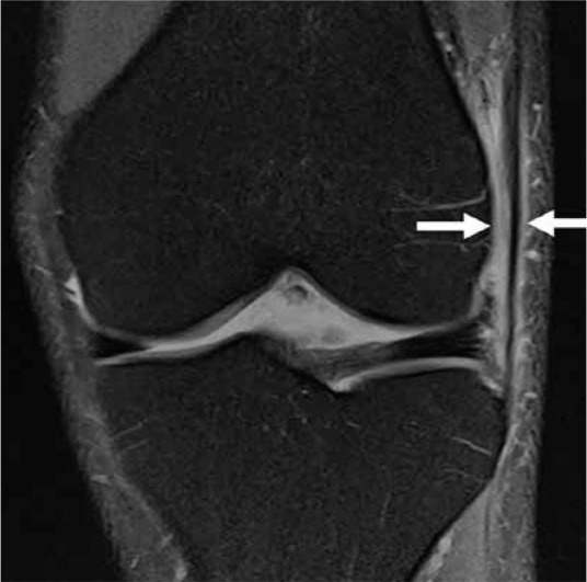 Figure 29