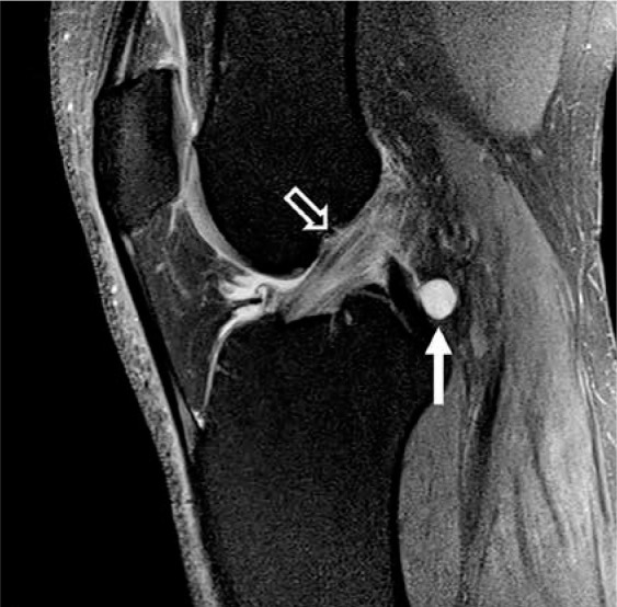 Figure 19