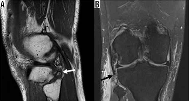 Figure 30