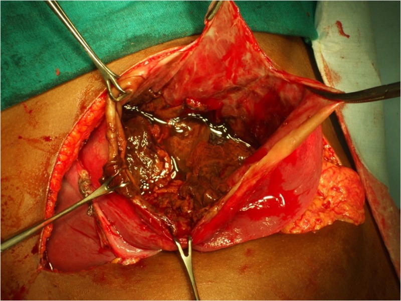 graphic file with name 12262_2012_753_Figb_HTML.jpg